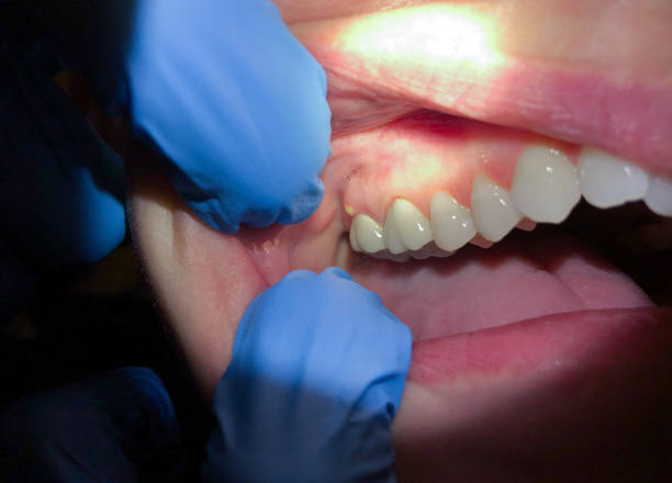 Best Emergency Dental Services for Seniors in Forest Park, GA